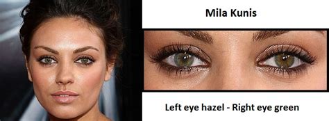 heterochromia iridis celebrities|Celebrities with Heterochromia .